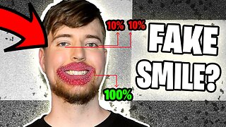 Is MrBeast’s Smile Fake or Real? A Deep Dive