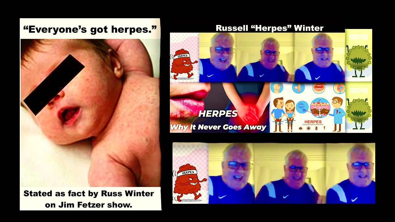 Russ Winter Claims GrandDaughter Has Herpes Tells Trusting Jim Fetzer Audience Everyone Has Herpes