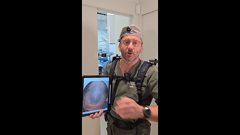 Patient With Bad Results from Previous Mill Clinic