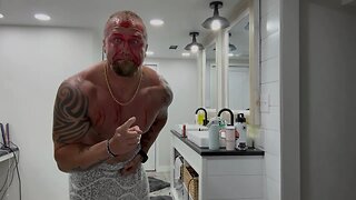 I Hit My Head Prank!!!