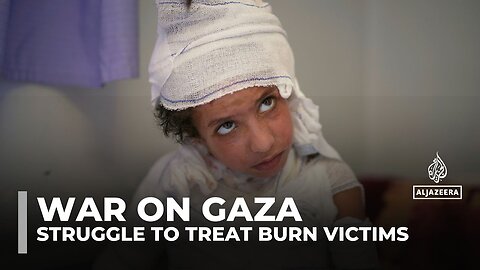 Gaza's burn patients suffer as Israel's blockade chokes crucial medical supplies