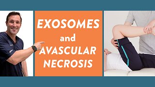 Exosomes and avascular necrosis