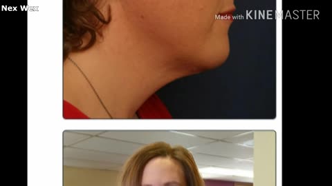 Almost every celebrity is hidden trans