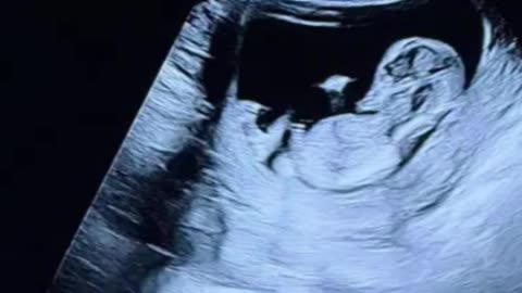 Elsie Hewitt Expecting First Child: Davidson Shares Joy and Parenting Inspiration