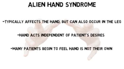 2-Minute Neuroscience Alien Hand Syndrome