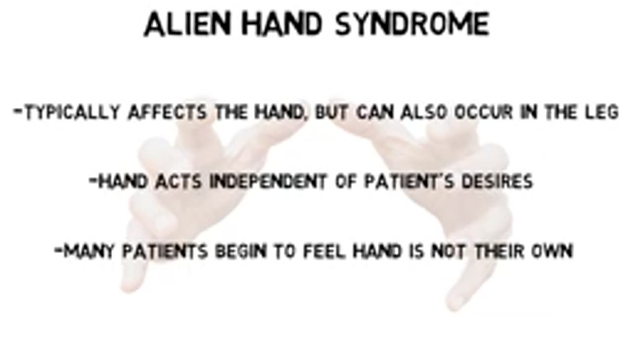 2-Minute Neuroscience Alien Hand Syndrome