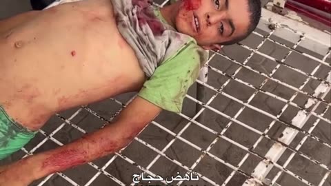 Israel slaughters kids in Gaza🇵🇸