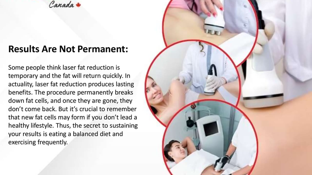 Debunking Some Common Myths About Laser Fat Reduction
