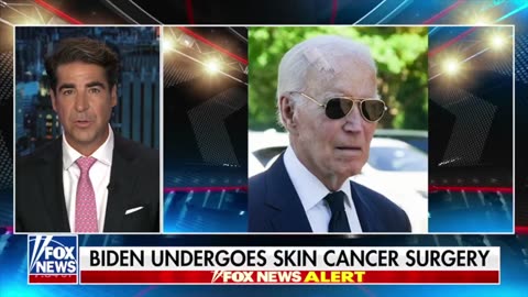 🚨Buydone diagnosed with another form of skin cancer