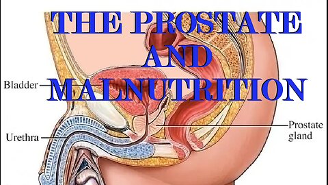 The Prostate and Malnutrition