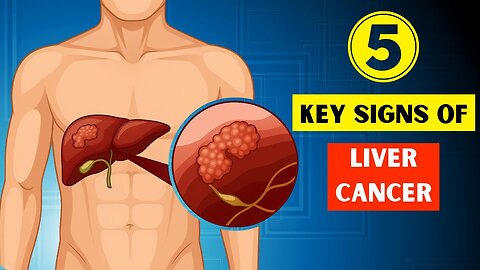 Notice These Five Key Warnings That Could Indicate Liver Cancer! MD05