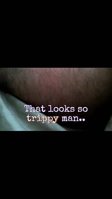 Extreme Leg Spasms | Looks Trippy | Rehabilitation Footage | Roadz Of Life Documentary (Short Clip)