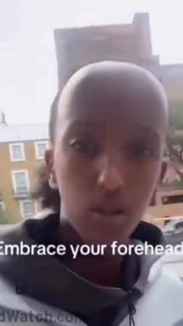 That's not a forehead. That's a fivehead or a sixhead