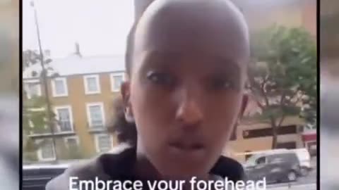 That's not a forehead. That's a fivehead or a sixhead