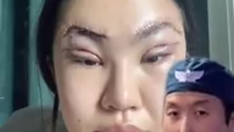 Amazing: A Disturbing Trend in Plastic Surgery? #shorts #plasticsurgery