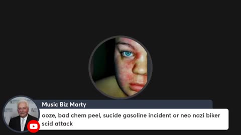 2022-5-28 Addressing Cyrax