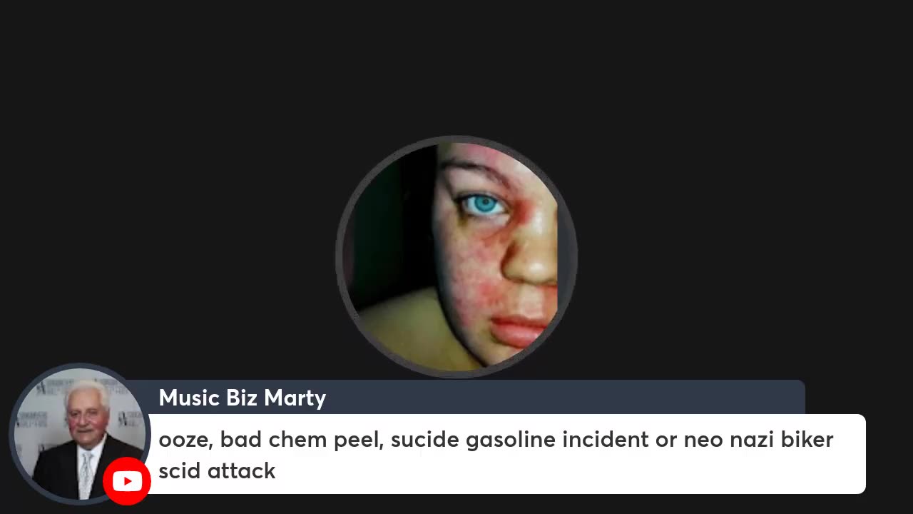 2022-5-28 Addressing Cyrax