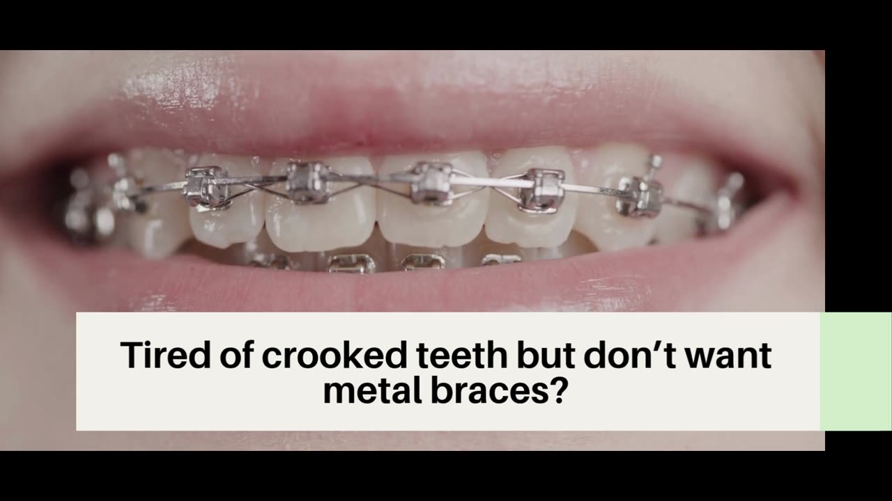 Invisalign in Philadelphia, PA