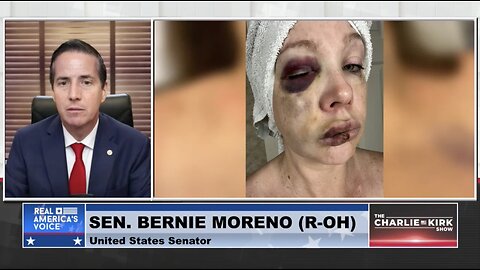 White Woman Nearly Beaten to Death By Black Mob: City Council Member Says She "Begged" For It