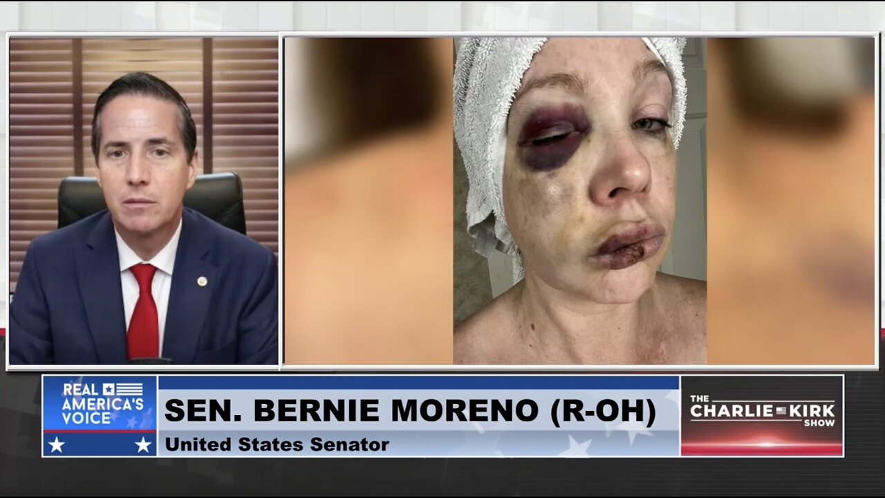 White Woman Nearly Beaten to Death By Black Mob: City Council Member Says She "Begged" For It