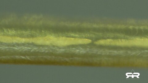 "Enormous Bio-Structures Discovered in Vaccinated Individuals"