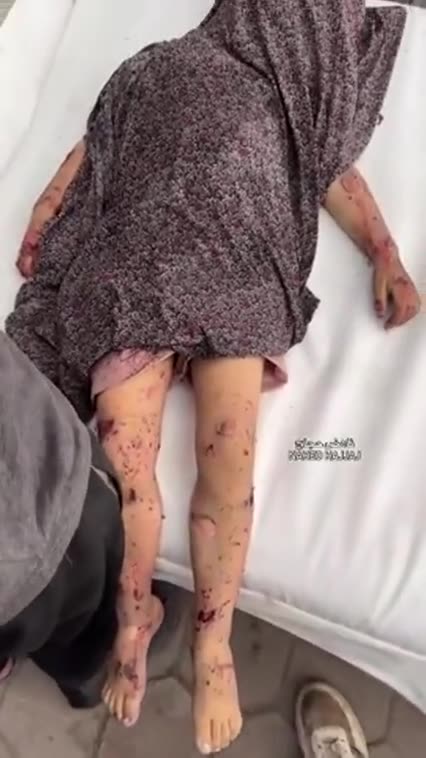 The US taxpayer funded jewish war hoax plastic girl!