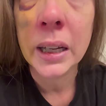 The General - BREAKING： The Cincinnati woman attacked by a mob has broken her silenCE