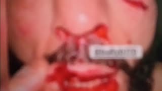 Belal is a warrior.....youtube banned this