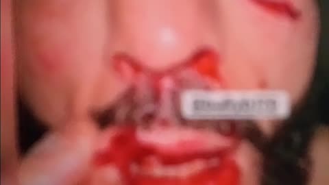 Belal is a warrior.....youtube banned this