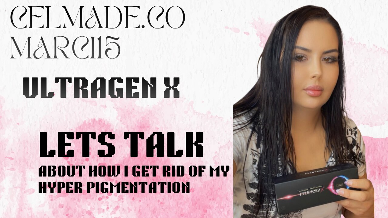 How I got rid of my hyperpigmentation at home with a product that actually WORKED