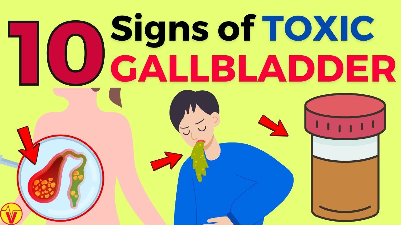 Detect Ten Critical Alerts Your Gallbladder’s Overwhelmed with Stones! VJ21