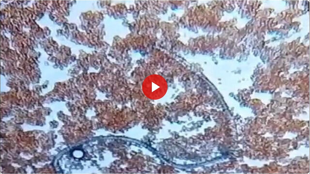 "Single Drop Analysis of Sinopharm Vaccinated Blood by Dr. Liliana Zelada"