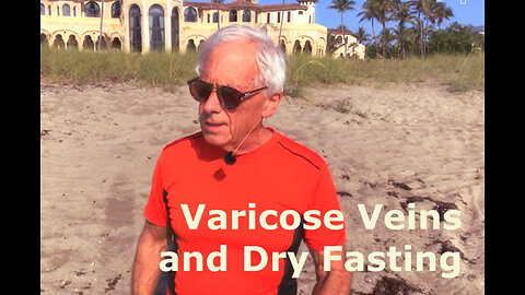 Varicose Veins and Dry Fasting