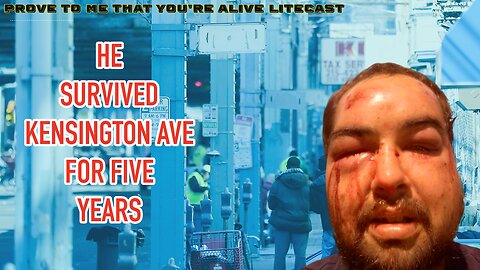 He Survived The Biggest Open Air Drug Market in America Kensington Ave Philadelphia