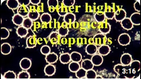 "Dark Field Microscope Application for Live Blood Analysis"