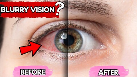 Blurry Vision Problem? See Clearly Again with This Natural Fix