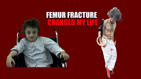 Breaking My Femur Changed My Life FOREVER