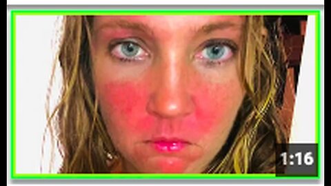 "Woman Experiences Severe Reaction to Pfizer Vaccine Injection"