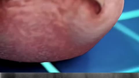 Nail safety trending video popular