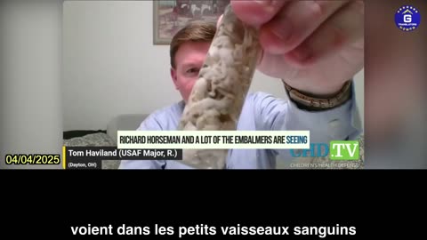 【FR】En 2024, 83 % des embaumeurs ont vu des caillots sanguins fibreux blancs chez les défunts