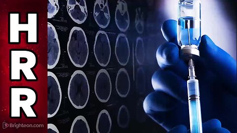 "COVID-19 Vaccines' Impact on Neurological Function: The Rise of ‘Neurological Dumbness’"