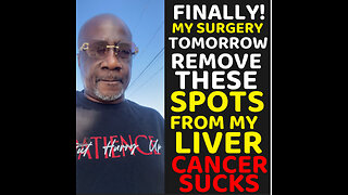 Finally my Liver Surgery to defeat Cancer