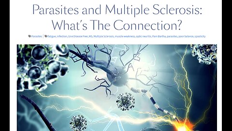 Multiple Sclerosis and the Parasite Connection