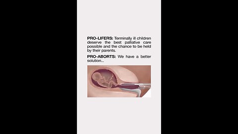 Abortion is not mercy