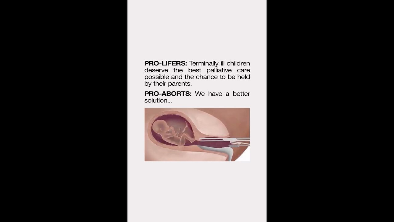 Abortion is not mercy