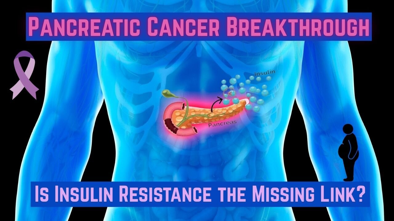 Insulin Resistance & Pancreatic Cancer