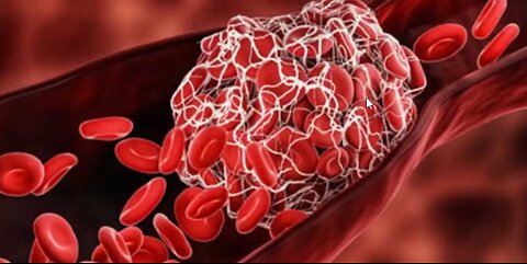 God made Blood Clots