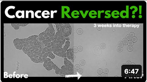 "Exploring Energy Medicine: Can Cancer Be Reversed? - Live Blood Analysis with Dr. Marlene Siegel"