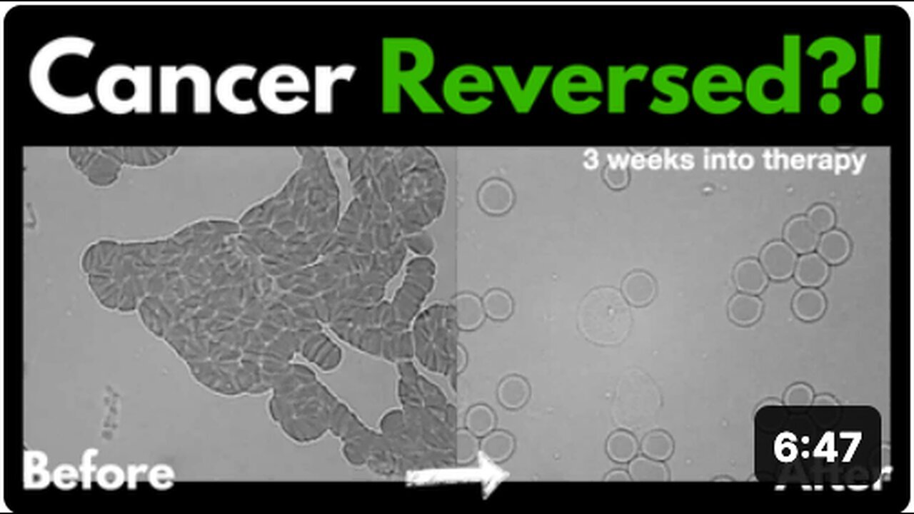 "Exploring Energy Medicine: Can Cancer Be Reversed? - Live Blood Analysis with Dr. Marlene Siegel"