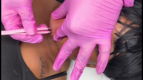 @beautybountykosmetics Performs Chin Waxing Using Sexy Smooth Tickled Pink Hard Wax